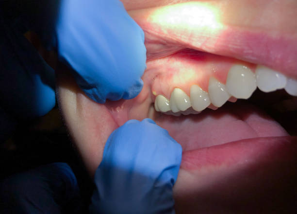 Best Cosmetic Emergency Dentistry in Baltic, SD